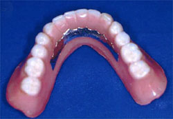 特殊調整義歯