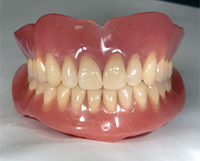 精密金属床義歯